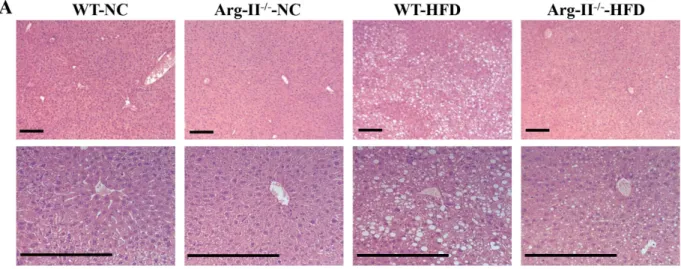 Figure 2.  HFD-induced hepatic steatosis is reduced in Arg-II −/−  mice. Presented are images of (A) HE  staining taken at two different magnifications