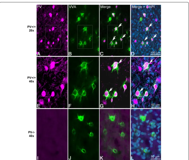 Fig. 1 Representative PV + and VVA + cells from PND25 mouse cortex. a, b Single channel acquisition of (a) PV + (magenta) and (b) VVA + (green) cells