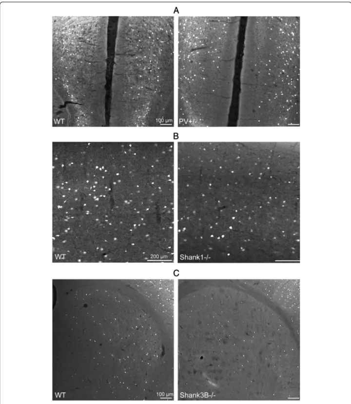 Fig. 2 PV immunofluorescence images from mPFC of a PV+/- (a), SSC of a Shank1-/- (b) and striatum of a Shank3B-/- (c) mouse in comparison to the same regions of a WT mouse