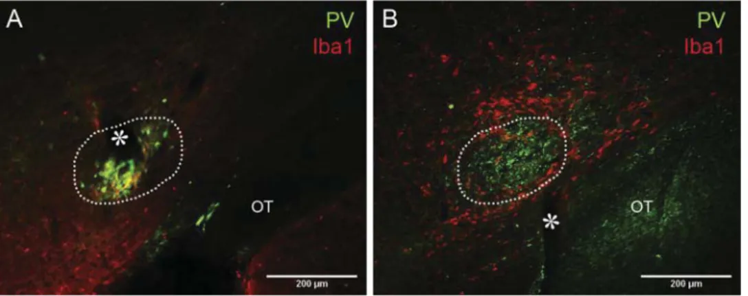 Fig. 3. Activated microglia appear in regions where neuronal death is evident.