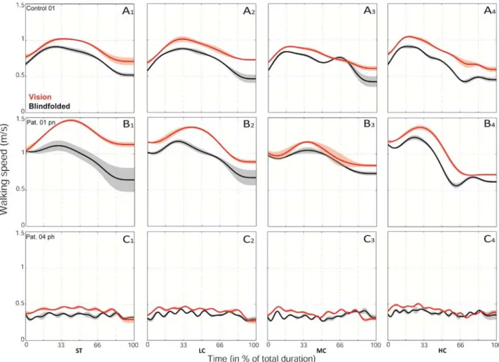 Fig. 3. Typical velocity proﬁles generated by control participants (A), non-hemiparetic (B) and hemiparetic (C) patients during trajectory completion