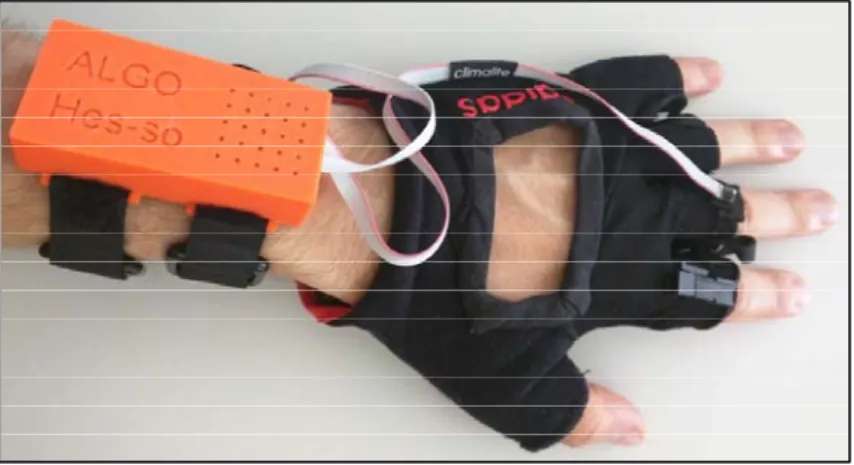 Figure 21 : Prototype du gant de diagnostic 