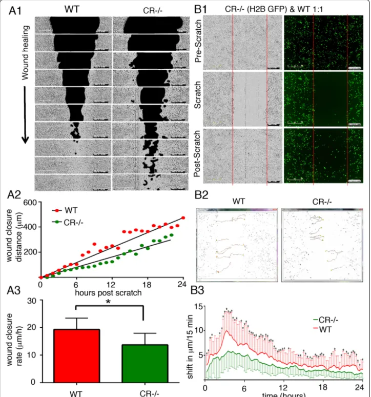 Fig. 4 a1 Time-lapse brightfield images were taken after a scratch (black area) was made at t = 0 in a confluent layer (grey area) of prMC from WT and CR − / − mice