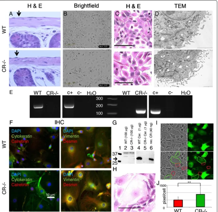 Fig. 1 a Hematoxylin and Eosin (HE) staining of a longitudinal section of small intestine from a WT and CR − / − mouse showing a normal mesothelium