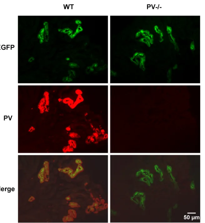 Fig 1. Immunohistochemical staining for PV (red) and EGFP (green) in the kidney of wildtype (WT) or PV-deficient (PV-/-) mice
