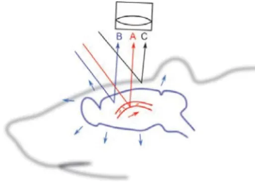 Figure 1 Speckle field back reflected from the brain tissue is formed by the light scattered by the moving blood cells in the  micovasculature (A), by the brain tissue matrix (B) and by the static skull (C)