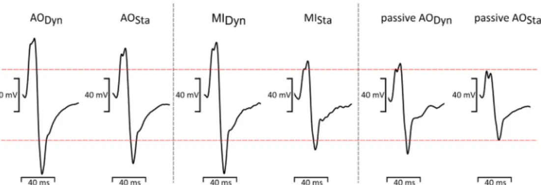 Fig. 2. Soleus MEP amplitudes of one exemplary subject showing the modulation across conditions