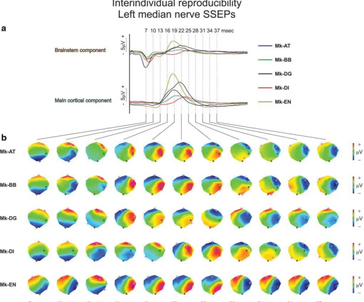 Fig. 5 Interindividual reproducibility of left median nerve SSEPs.