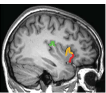 Figure 1. Lateral view on the left insular cortex. The primary interoceptive cortex in the posterior and anterior areas of the dorsal fundus of the insula (idfp and idfa) are marked in green, and the dorsal and ventral portions of the anterior insular cort