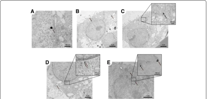 Fig. 8 TEM images of intracellular particles in the A549 CML. (a) Agglomerates, (b, c) small agglomerates and (d) single particles in the cytoplasm and (e) particles next to the cell nucleus 24 h after exposure to 100 ng/cm 2 18 nm AuNP in the ALICE system