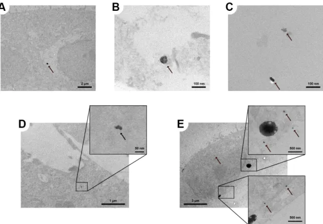 Figure   S7:   TEM   images   of   intracellular   particles   in   the   A549   CML.   Agglomerates   of   (A)   2   nm   and                                                                                                                         (B,C,D)  