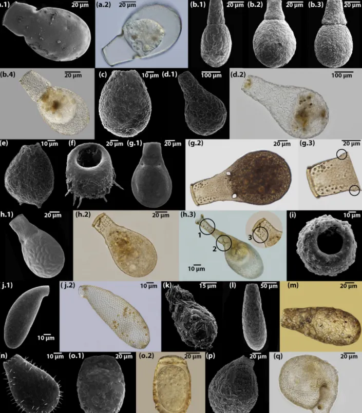 Fig. 6. Scanning electron microscopy and light micrographs of typical testate amoeba taxa found in Chile: (a) Alocodera cockayni (Penard, 1910): (a.1) from a peatland, TDF; and (a.2) living individual from a rainforest, SC