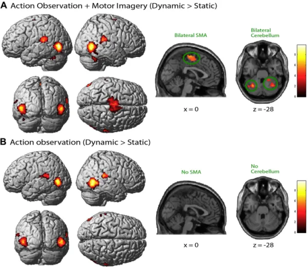 Fig. 3 e Contrasts in brain activity between the dynamic (perturbation) and static balance (standing) condition for AO þ MI (A) and AO (B)