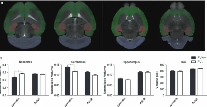 Figure 4. Absence of parvalbumin in PV −/− mice induces transient neocortical hypertrophy and cerebellar hypoplasia in male juvenile (PND20) mice