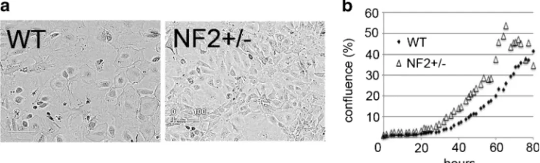 Figure 1. Morphology (a) and growth characteristics (b) of primary mesothelial cells isolated from WT and Nf2+/ − mice, both grown in Connell ’ s medium