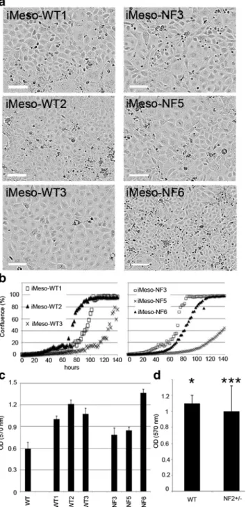 Figure 2. Immortalized mesothelial cell morphology and cell growth in DMEM+10% FBS. (a) Brightfield images were taken with the Incucyte Live Cell Imaging system (FLR 10×) and show immortalized mesothelial cell clones derived from WT and Nf2+/ − mice