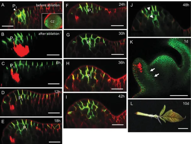 Fig. 4. Development of the apex and expression of PIN1-GFP after ablation of the incipient midvein of P 1 