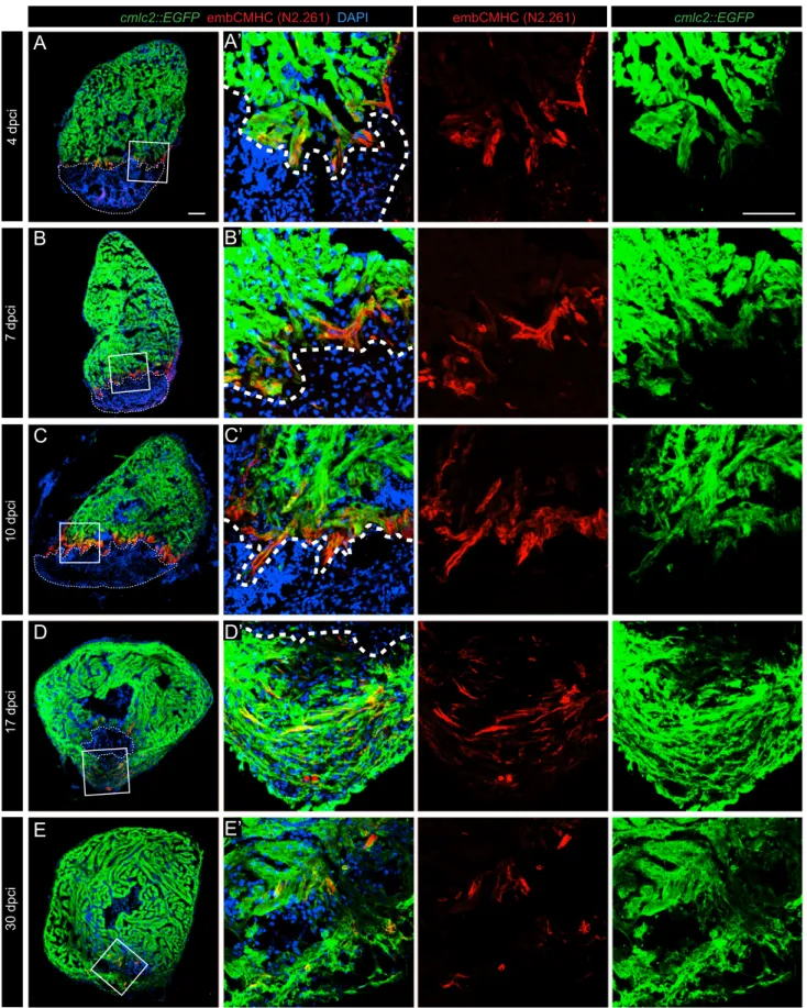Fig. 5. N2.261 immunostaining reveals a reactivation of embCMHC expression at the vicinity of the post-infarcted tissue