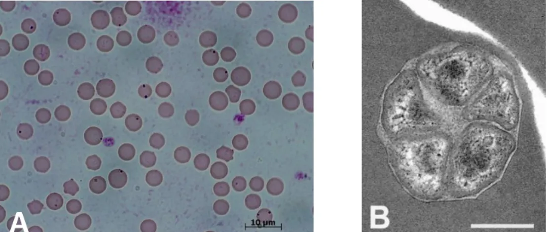 Figure  1.4.  Bovine  erythrocytes  infected  with  A.  marginale.  A).  Organisms  are  seen  as  black,  irregular  shaped  dots,  usually  at  the  edge  of  infected  red  blood  cells,  Giemsa  staining,  B)