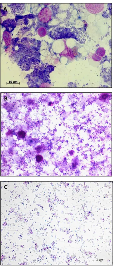 Figure 2.1. The purity of  A. marginale assessed during different steps of the  purification process by Giemsa staining: A)