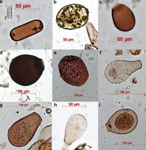 Fig. 2. Pictures of the selected testate amoeba morpho-taxa: (a) Archerella ﬂavum, (b) Amphitrema wrightianum, (c) Assulina muscorum, (d) Assulina seminulum, (e) Heleopera rosea, (f) Hyalosphenia elegans, (g) Hyalosphenia papilio, (h) Nebela militaris, and