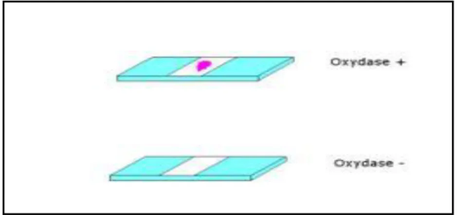 Figure 26 : Test oxydase  [4]. 
