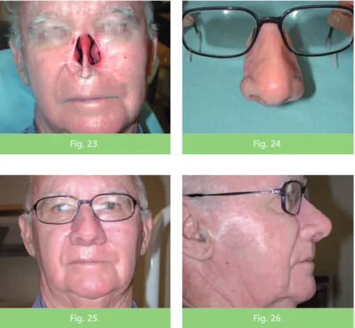 Fig. 23 . Fig. 24 .