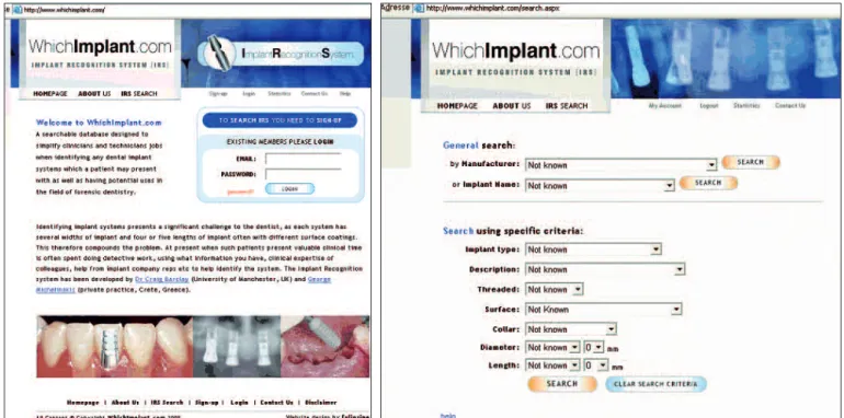 Fig. 3 a et b Page d’accueil et méthode de recherche sur www.whichimplant.com (IRS).