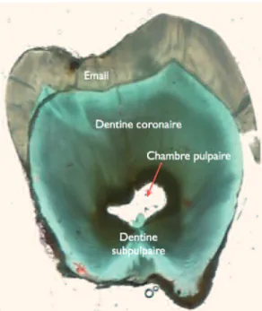 Fig. 3 Coupe et sa coloration de Goldner.