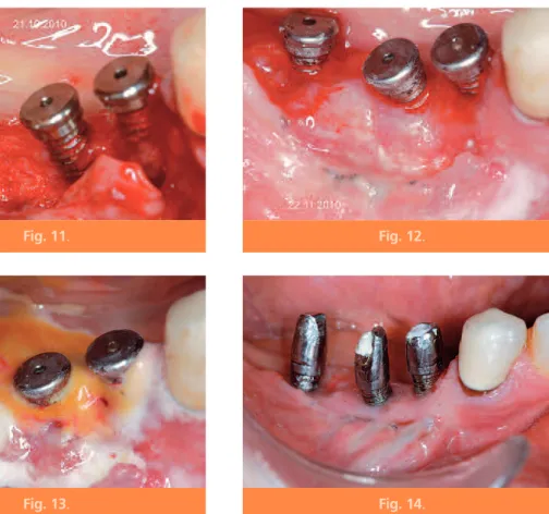 Fig. 11 . Fig. 12 .