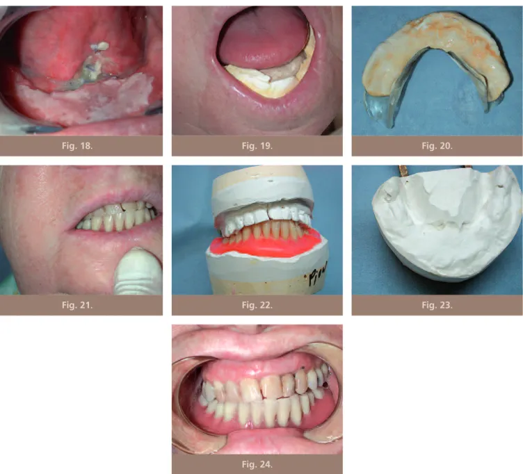 Fig. 18 . Fig. 19 . Fig. 20 .