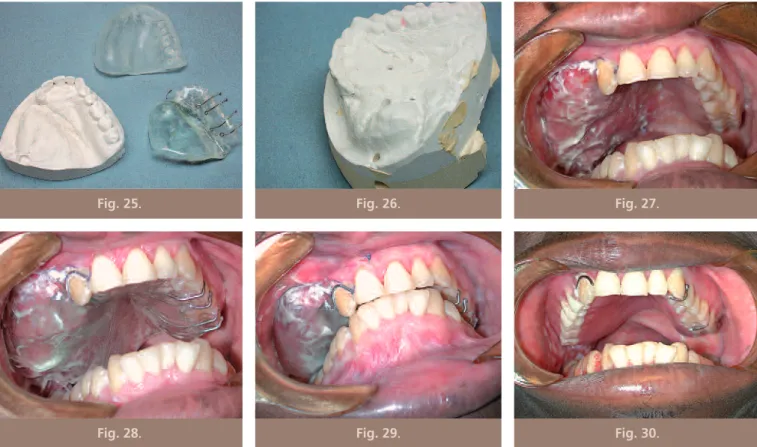 Fig. 25 . Fig. 26 . Fig. 27 .