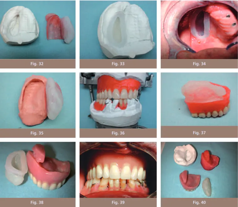 Fig. 38 Fig. 39 Fig. 40