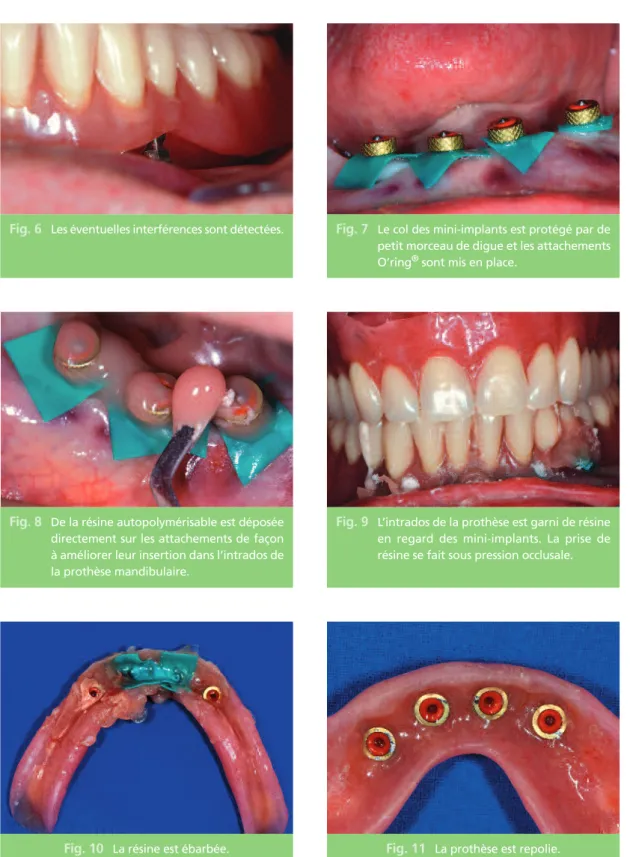 Fig. 6 Les éventuelles interférences sont détectées.