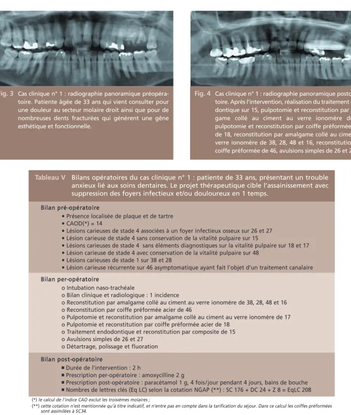 Tableau V Bilans opératoires du cas clinique n° 1 : patiente de 33 ans, présentant un trouble anxieux lié aux soins dentaires