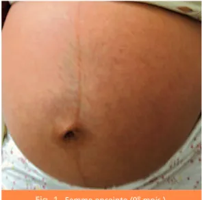 Fig. 1 Femme enceinte (9 e mois ).