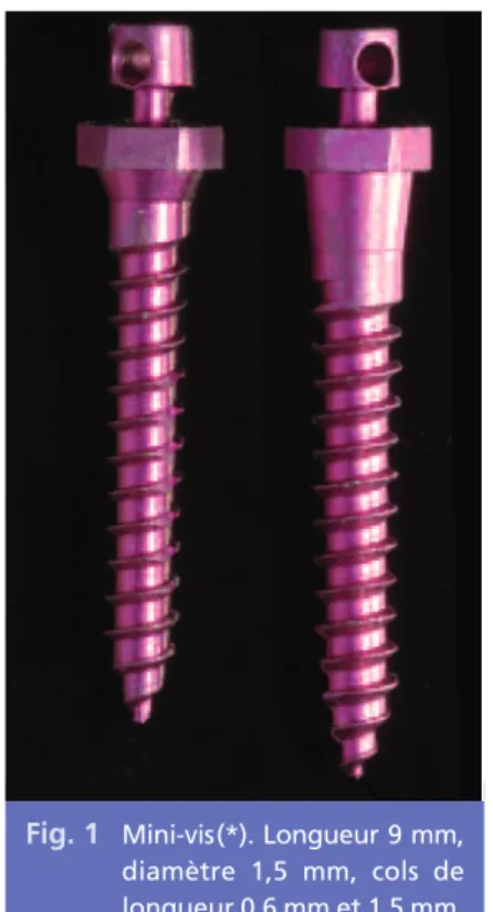 Fig. 1 Mini-vis(*). Longueur 9 mm, diamètre  1,5  mm,  cols  de longueur 0,6 mm et 1,5 mm.