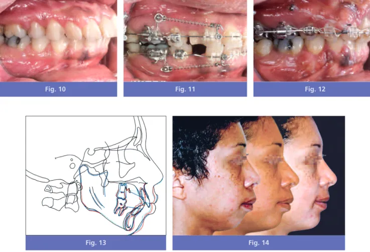 Fig. 10 Fig. 11 Fig. 12