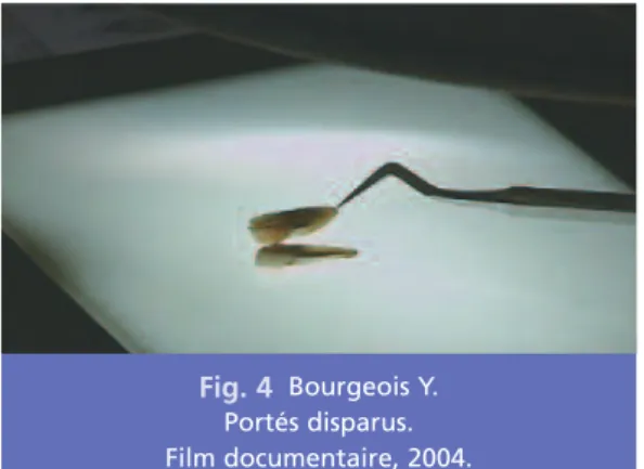 Fig. 4 Bourgeois Y.