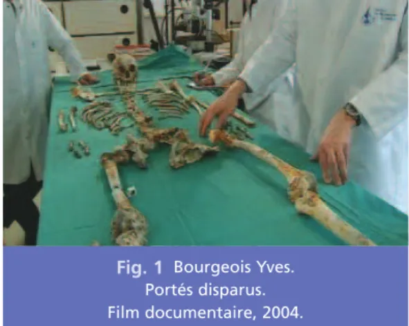 Fig. 1 Bourgeois Yves.