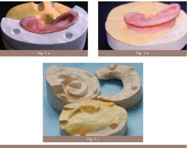 Fig. 1 Mise en moufle de la maquette en cire.
