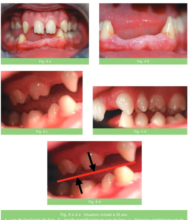 Fig. 4 a Fig. 4 b