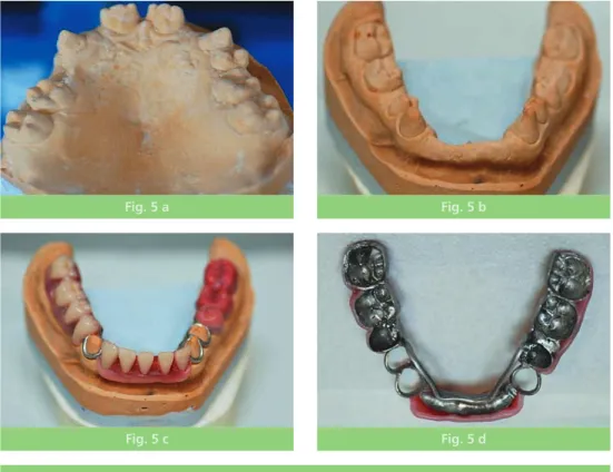 Fig. 5 a Fig. 5 bla nécessité d’une reconstruction préalable
