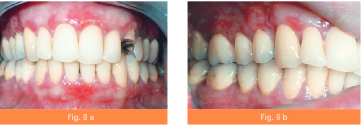 Fig. 8 a Fig. 8 b