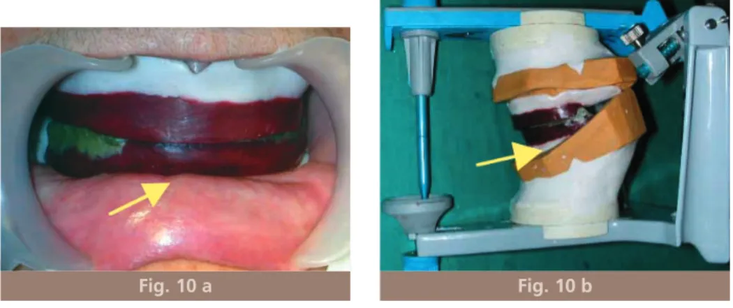 Fig. 10 a Fig. 10 b