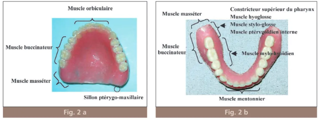 Fig. 1 a et b Coupe frontale et sagittale montrant les structures délimitant le couloir prothétique.