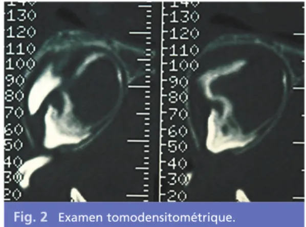 Fig. 1 Radiographie panoramique lors de la pre- pre-mière consultation.