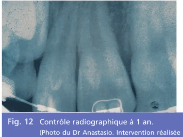 Fig. 12 Contrôle radiographique à 1 an.