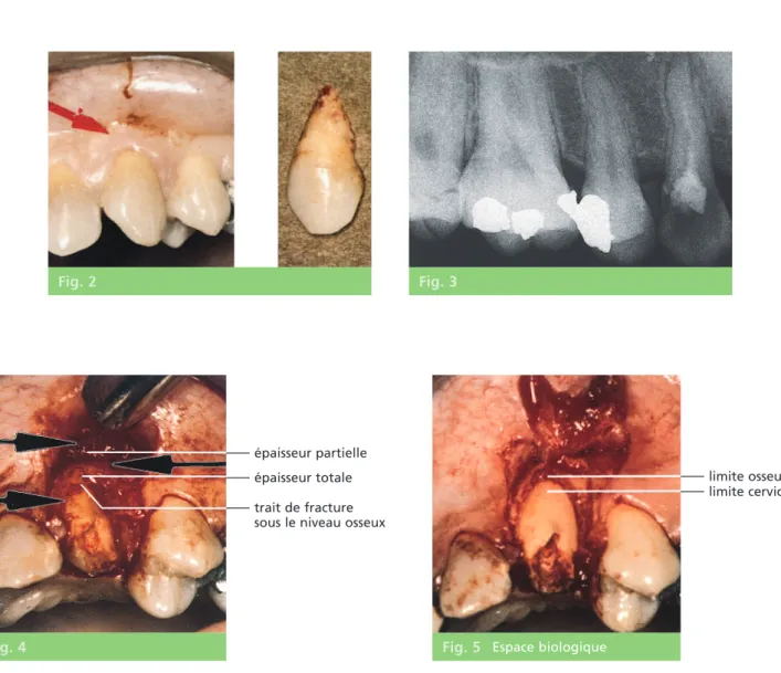 Fig. 2 Fig. 3
