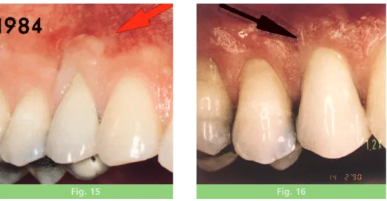 Fig. 15 Fig. 16